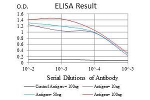 Black line: Control Antigen (100 ng), Purple line: Antigen(10 ng), Blue line: Antigen (50 ng), Red line: Antigen (100 ng), (COTL1 antibody)