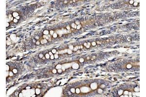 IHC analysis of CLPB using anti-CLPB antibody (ABIN7601732). (CLPB antibody  (AA 438-707))