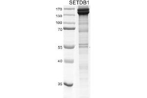 Recombinant SETDB1 protein gel. (SETDB1 Protein (DYKDDDDK Tag))