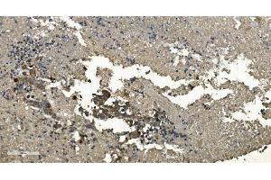 IHC analysis of RGS6 using anti-RGS6 antibody (ABIN7602326). (RGS6 antibody  (AA 7-357))