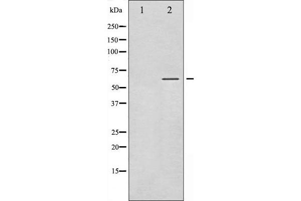 SGK1 antibody  (pSer422)