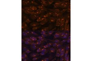 Immunofluorescence analysis of C6 cells using G antibody (ABIN6133219, ABIN6140940, ABIN6140941 and ABIN6222644) at dilution of 1:100. (GALNT2 antibody  (AA 442-571))