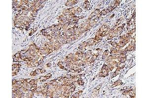 IHC analysis of Hexokinase 1/HK1 using anti-Hexokinase 1/HK1 antibody (ABIN7600260). (Hexokinase 1 antibody  (AA 17-323))