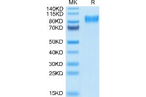 Mouse Osteoactivin/GPNMB on Tris-Bis PAGE under reduced condition. (Osteoactivin Protein (GPNMB) (AA 23-502) (His tag))