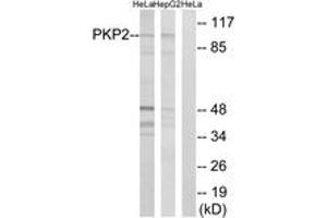 Western blot analysis of extracts from HeLa/HepG2 cells, using PKP2 Antibody.