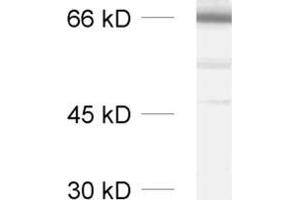 dilution: 1 : 1000, sample: synaptic vesicle fraction of rat brain (LP2) (SYT2 antibody  (Cytoplasmic Domain))