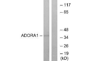 Western blot analysis of extracts from MCF-7 cells, using ADORA1 antibody. (ADORA1 antibody  (C-Term))