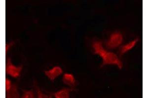 ABIN6269028 staining HeLa by IF/ICC. (CDKN2B antibody  (Internal Region))