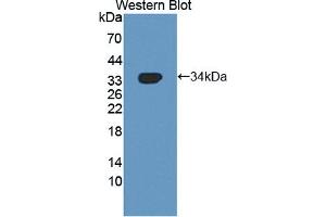 Figure. (NUAK1 antibody  (AA 421-658))