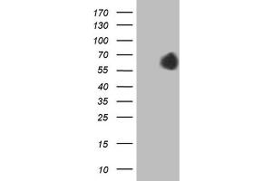Western Blotting (WB) image for anti-alpha-Fetoprotein (AFP) (AA 19-397) antibody (ABIN2716010) (alpha Fetoprotein antibody  (AA 19-397))