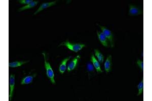 Immunofluorescent analysis of Hela cells using ABIN7163973 at dilution of 1:100 and Alexa Fluor 488-congugated AffiniPure Goat Anti-Rabbit IgG(H+L) (KCND1 antibody  (AA 410-647))