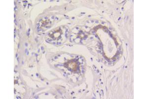Immunohistochemistry of paraffin-embedded human breast using MCL1 antibody (ABIN4904325) at dilution of 1:100 (40x lens). (MCL-1 antibody)