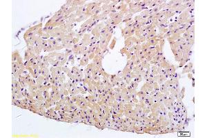 Formalin-fixed and paraffin embedded rat heart tissue labeled with Anti-ERK4 Polyclonal Antibody, Unconjugated (ABIN754288) at 1:200 followed by conjugation to the secondary antibody and DAB staining (MAPK7 antibody  (AA 401-500))