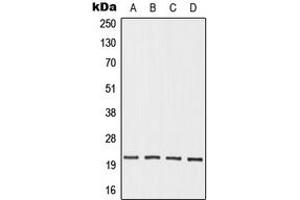 Western blot analysis of OAZ3 expression in HEK293T (A), Jurkat (B), mouse testis (C), rat testis (D) whole cell lysates. (OAZ3 antibody  (Center))