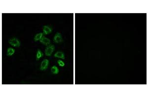 Immunofluorescence analysis of MCF-7 cells, using GPRC5B antibody. (GPRC5B antibody  (Internal Region))