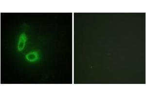 Immunofluorescence analysis of HeLa cells, using EFNA1 Antibody. (Ephrin A1 antibody  (AA 66-115))