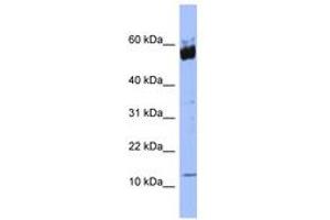 Image no. 1 for anti-S100 Calcium Binding Protein A9 (S100A9) (N-Term) antibody (ABIN6741664) (S100A9 antibody  (N-Term))