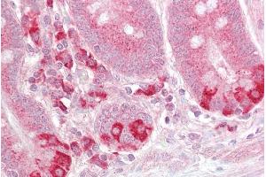 ABIN185596 (2. (TRAF1 antibody  (C-Term))