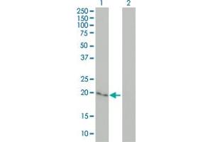 Western Blot analysis of CYGB expression in transfected 293T cell line by CYGB monoclonal antibody (M02), clone 1A1. (CYGB antibody  (AA 1-190))