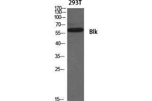 Western Blotting (WB) image for anti-B Lymphoid Tyrosine Kinase (BLK) (Ser180) antibody (ABIN3174029) (BLK antibody  (Ser180))
