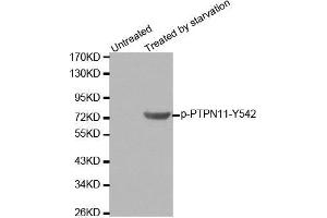 Western blot analysis of extracts from 293 cells using Phospho-PTPN11-Y542 antibody. (PTPN11 antibody  (pTyr542))
