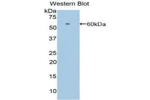 Detection of Recombinant LRP8, Human using Polyclonal Antibody to Low Density Lipoprotein Receptor Related Protein 8 (LRP8) (LRP8 antibody  (AA 696-941))