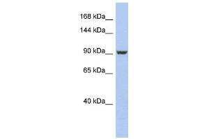 PMS2 antibody used at 1 ug/ml to detect target protein.