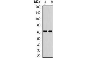 Western blot analysis of EPHX2 expression in MCF7 (A), Jurkat (B) whole cell lysates. (EPHX2 antibody)