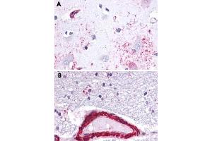 Immunohistochemical staining of formalin-fixed, paraffin-embedded human brain, astrocytes tissue after heat-induced antigen retrieval. (Apelin Receptor antibody  (3rd Cytoplasmic Domain))