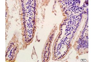 Formalin-fixed and paraffin embedded mouse intestine labeled with Anti ASBT/SLC10A2 Polyclonal Antibody, Unconjugated  at 1:200 followed by conjugation to the secondary antibody and DAB staining. (SLC10A2 antibody  (AA 131-230))