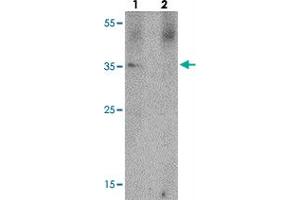Western blot analysis of PRKCDBP in A-20 cell lysate with PRKCDBP polyclonal antibody  at 1 ug/mL in (lane 1) the absence and (lane 2) the presence of blocking peptide. (PRKCDBP antibody  (Internal Region))