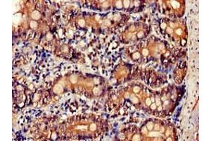 Immunohistochemistry of paraffin-embedded human small intestine tissue using ABIN7156899 at dilution of 1:100 (IL-34 antibody  (AA 191-240))