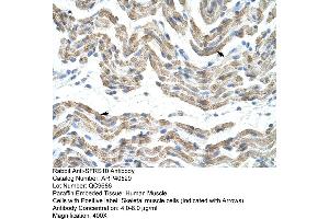 Rabbit Anti-SFRS10 Antibody  Paraffin Embedded Tissue: Human Muscle Cellular Data: Skeletal muscle cells Antibody Concentration: 4. (TRA2B antibody  (Middle Region))