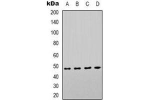 Western blot analysis of COX10 expression in Hela (A), HEK293T (B), mouse kidney (C), mouse brain (D) whole cell lysates.