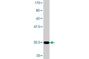 Western Blot detection against Immunogen (31.
