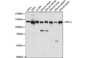 Western blot analysis of extracts of various cell lines, using IPO11 antibody (ABIN7267854) at 1:1000 dilution. (Importin 11 antibody  (AA 776-975))