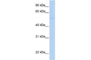 WB Suggested Anti-PRF1 Antibody Titration:  0. (Perforin 1 antibody  (N-Term))