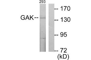 Western blot analysis of extracts from 293 cells, using GAK antibody. (GAK antibody  (N-Term))