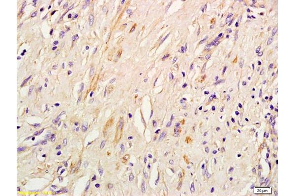 IRS3 antibody  (AA 261-360)