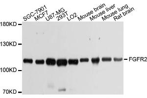 Western blot analysis of extracts of various cell lines, using FGFR2 antibody. (FGFR2 antibody)