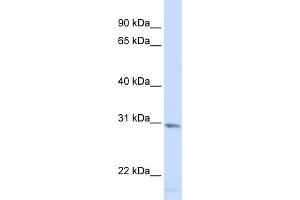 WB Suggested Anti-SMUG1 Antibody Titration: 0. (SMUG1 antibody  (Middle Region))