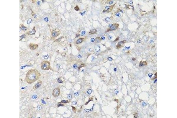 BCS1L antibody