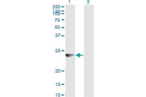 RAB7B antibody  (AA 100-199)