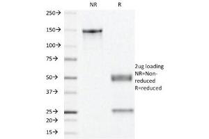 SDS-PAGE Analysis of Purified, BSA-Free Progesterone Receptor Antibody (clone PR501). (Progesterone Receptor antibody)