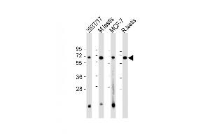 All lanes : Anti-FEM1B Antibody (C-Term) at 1:2000 dilution Lane 1: 293T/17 whole cell lysate Lane 2: mouse testis lysate Lane 3: MCF-7 whole cell lysate Lane 4: rat testis lysate Lysates/proteins at 20 μg per lane. (FEM1B antibody  (AA 547-579))