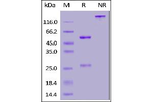 Anti-SARS-CoV-2 Spike RBD Antibody, Chimeric mAb, Human IgG1 (ABIN6953206) on SDS-PAGE under reducing (R) and non-reducing (NR) conditions. (SARS-CoV-2 Spike S1 antibody)