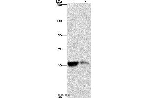 Western blot analysis of Mouse liver and kidney tissue, using ALDH8A1 Polyclonal Antibody at dilution of 1:550