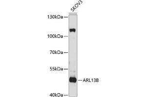 Western blot analysis of extracts of SKOV3 cells, using B antibody (ABIN6130859, ABIN6137109, ABIN6137110 and ABIN6220869) at 1:1000 dilution. (ARL13B antibody  (AA 1-240))