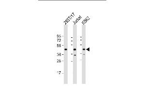 All lanes : Anti-PHF6 Antibody (Center) at 1:2000 dilution Lane 1: 293T/17 whole cell lysate Lane 2: Jurkat whole cell lysate Lane 3: K562 whole cell lysate Lysates/proteins at 20 μg per lane. (PHF6 antibody  (AA 148-180))
