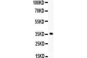 Anti- KLF6 antibody, Western blotting All lanes: Anti KLF6  at 0. (KLF6 antibody  (AA 38-205))